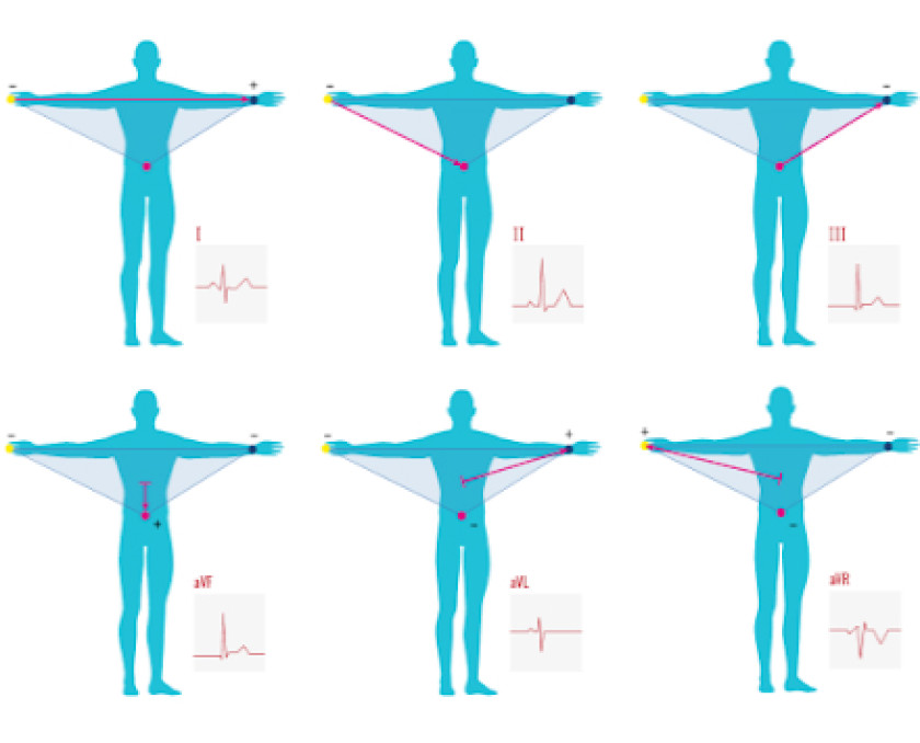 ELECTROCARDIOGRAM / 6-LEAD ECG RECORDING | Teltonika